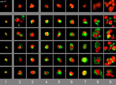 Hypoxia Promotes Neutrophil Survival After Acute Myocardial Infarction